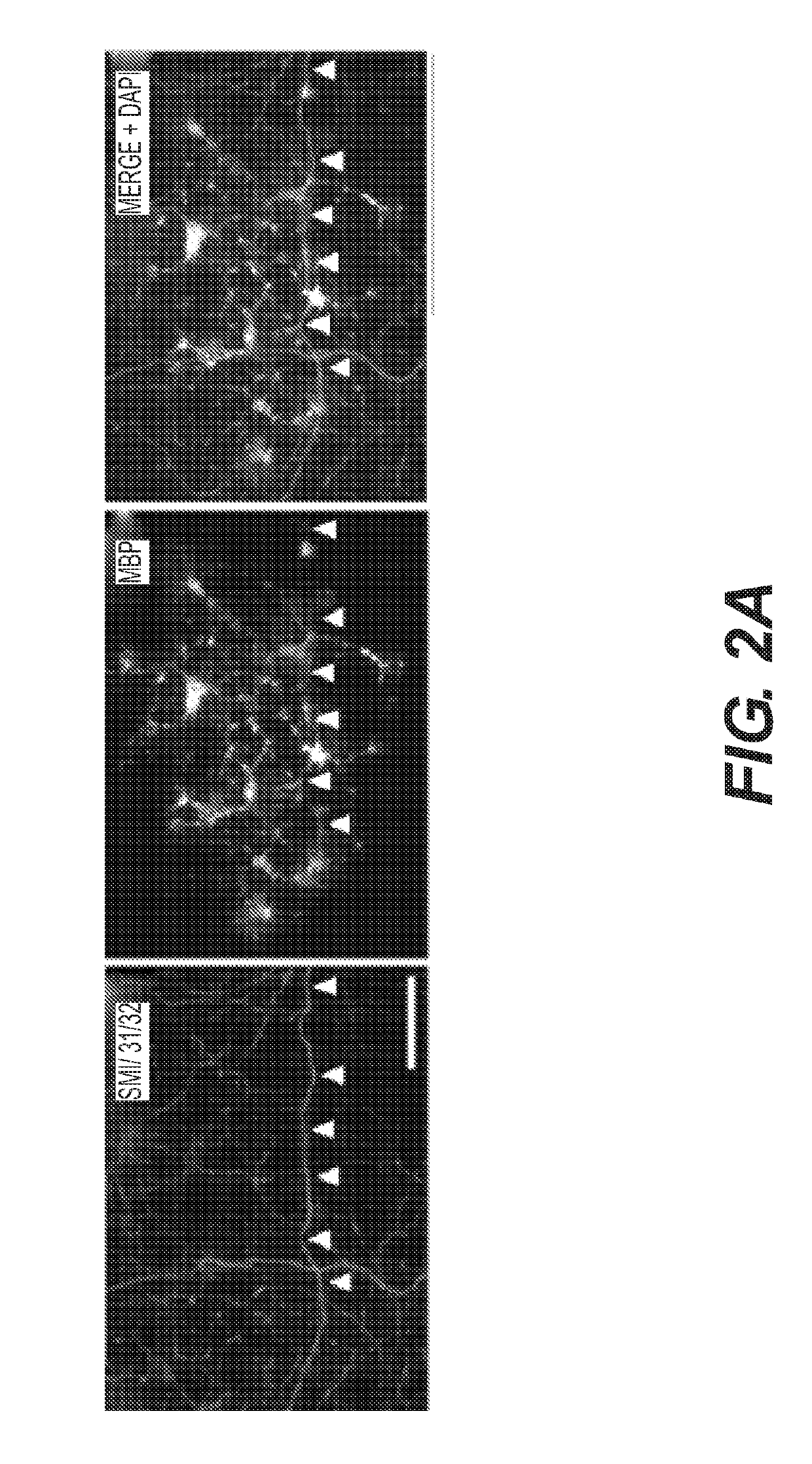 Methods and Compositions for the Treatment of Demyelinating Disorders