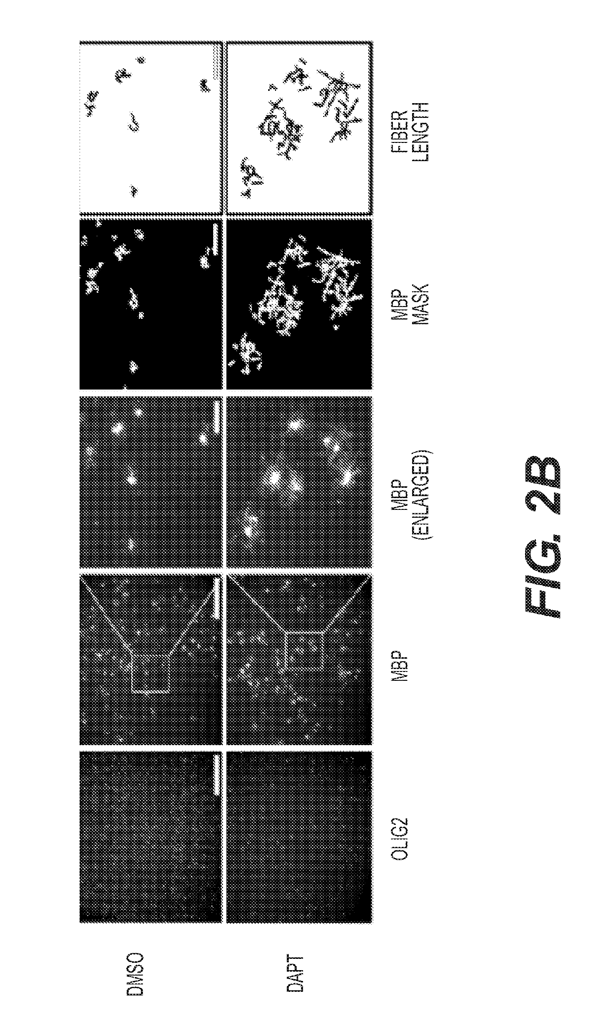 Methods and Compositions for the Treatment of Demyelinating Disorders