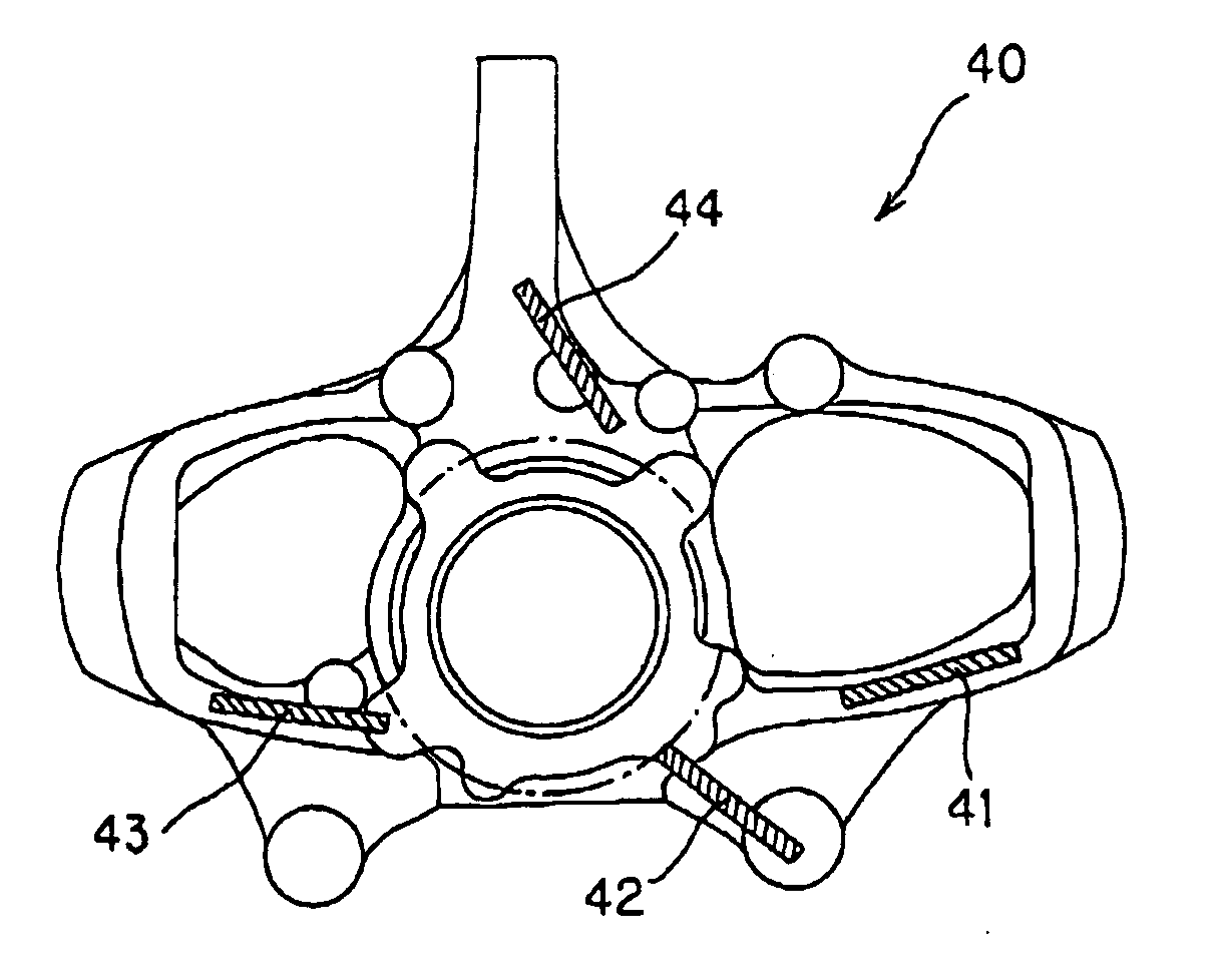 Aluminum alloy for casting-forging, aluminum casting-forging product and processes for production thereof