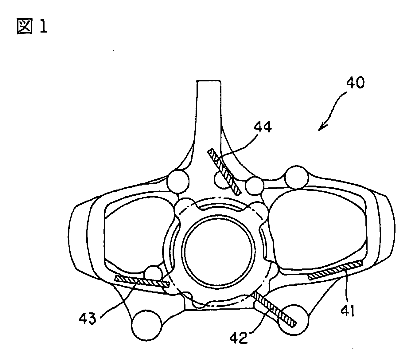 Aluminum alloy for casting-forging, aluminum casting-forging product and processes for production thereof