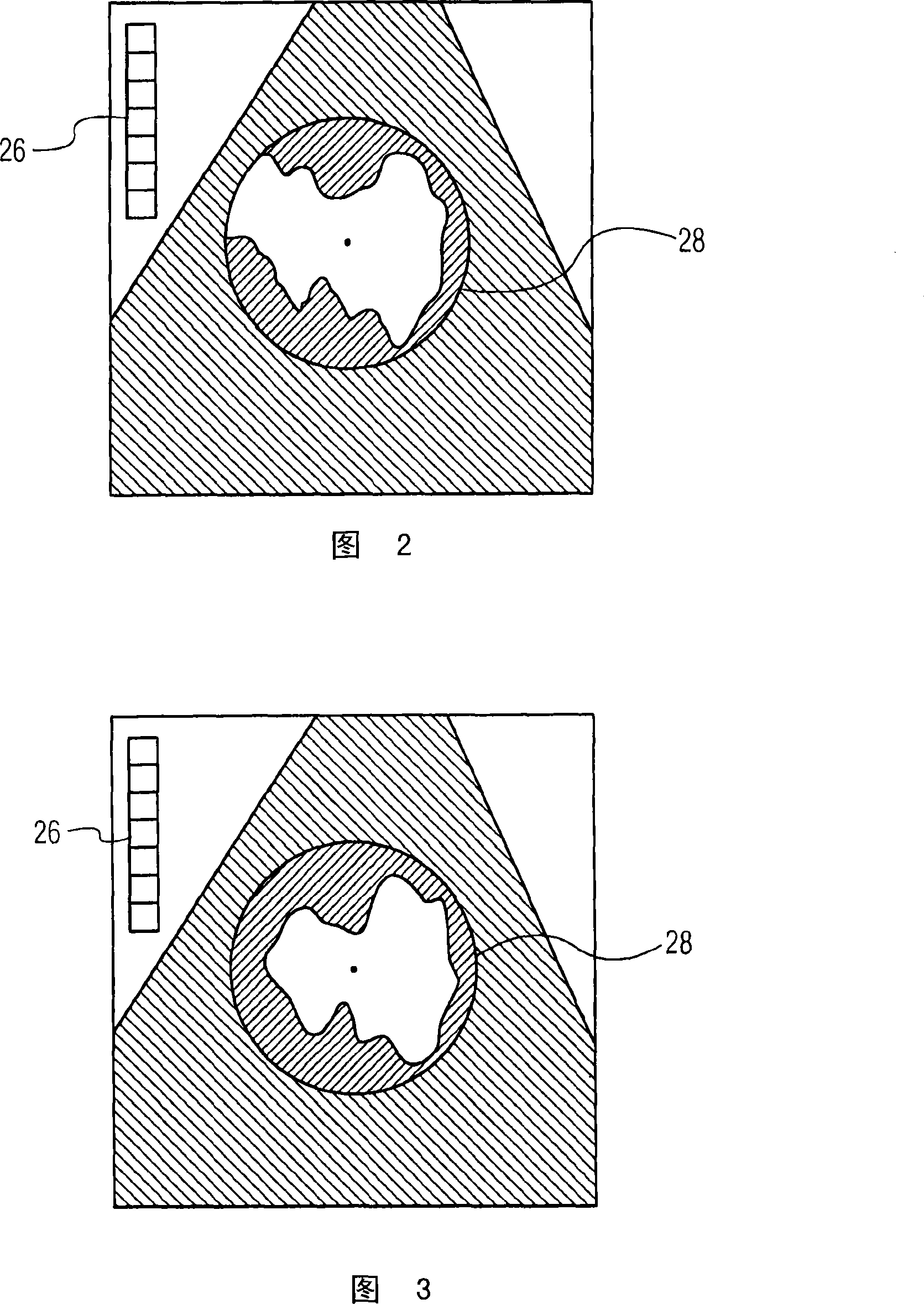 Targeted additive gain tool for processing ultrasound images