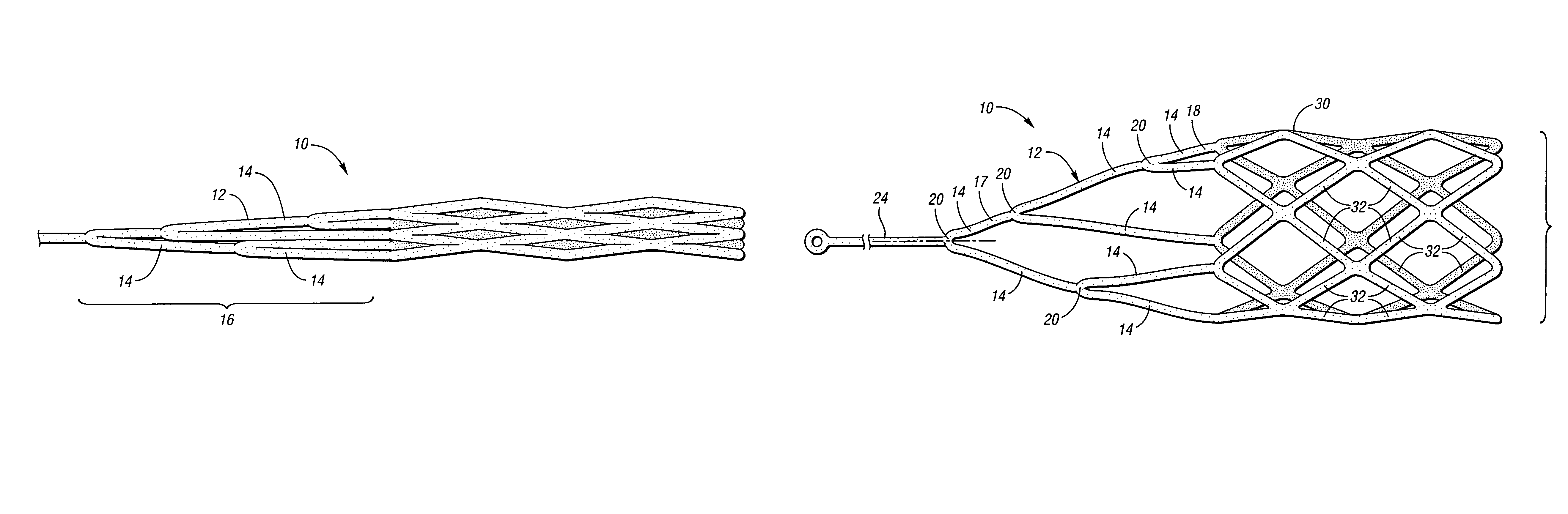 Retrievable device having a reticulation portion with staggered struts
