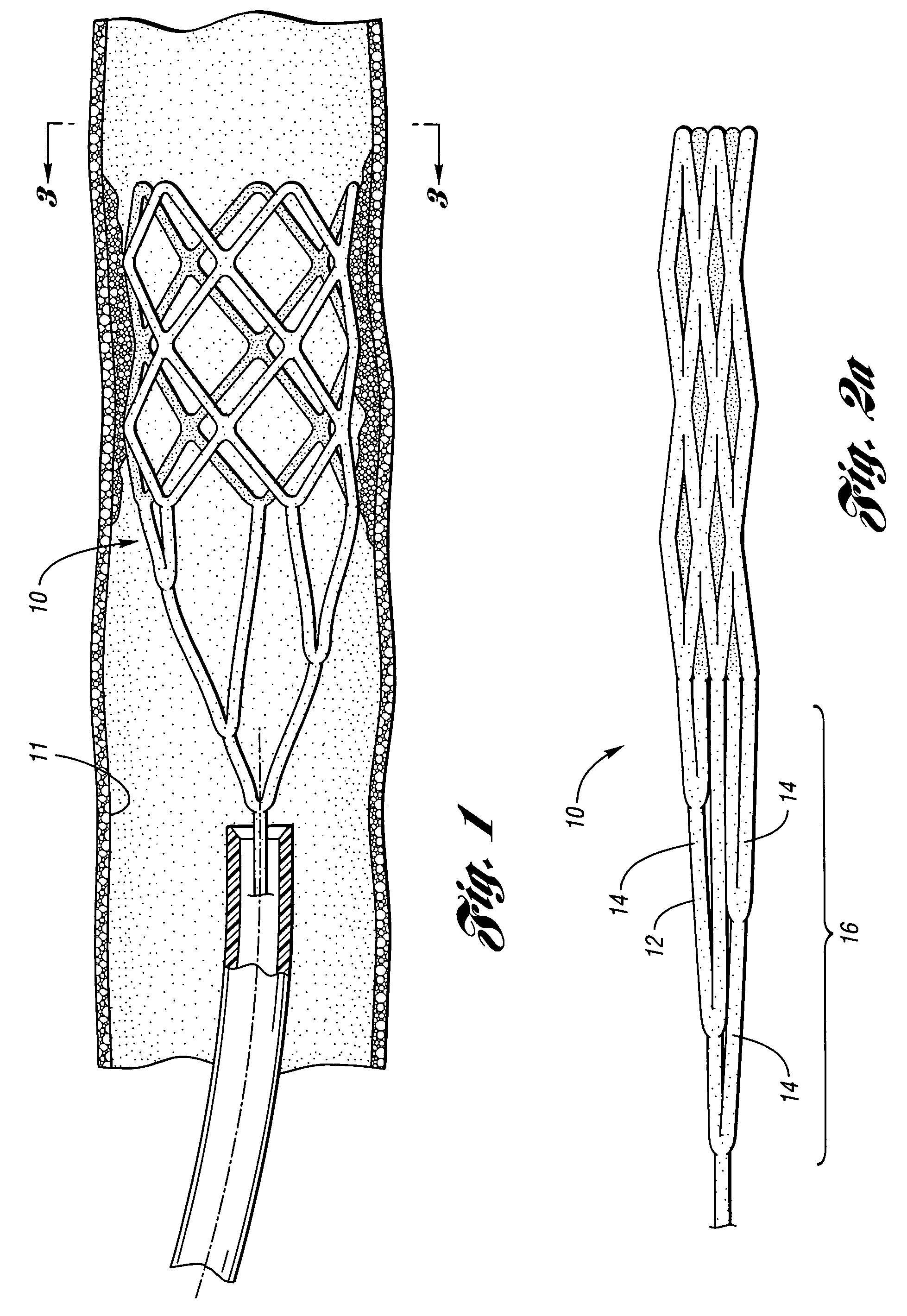 Retrievable device having a reticulation portion with staggered struts