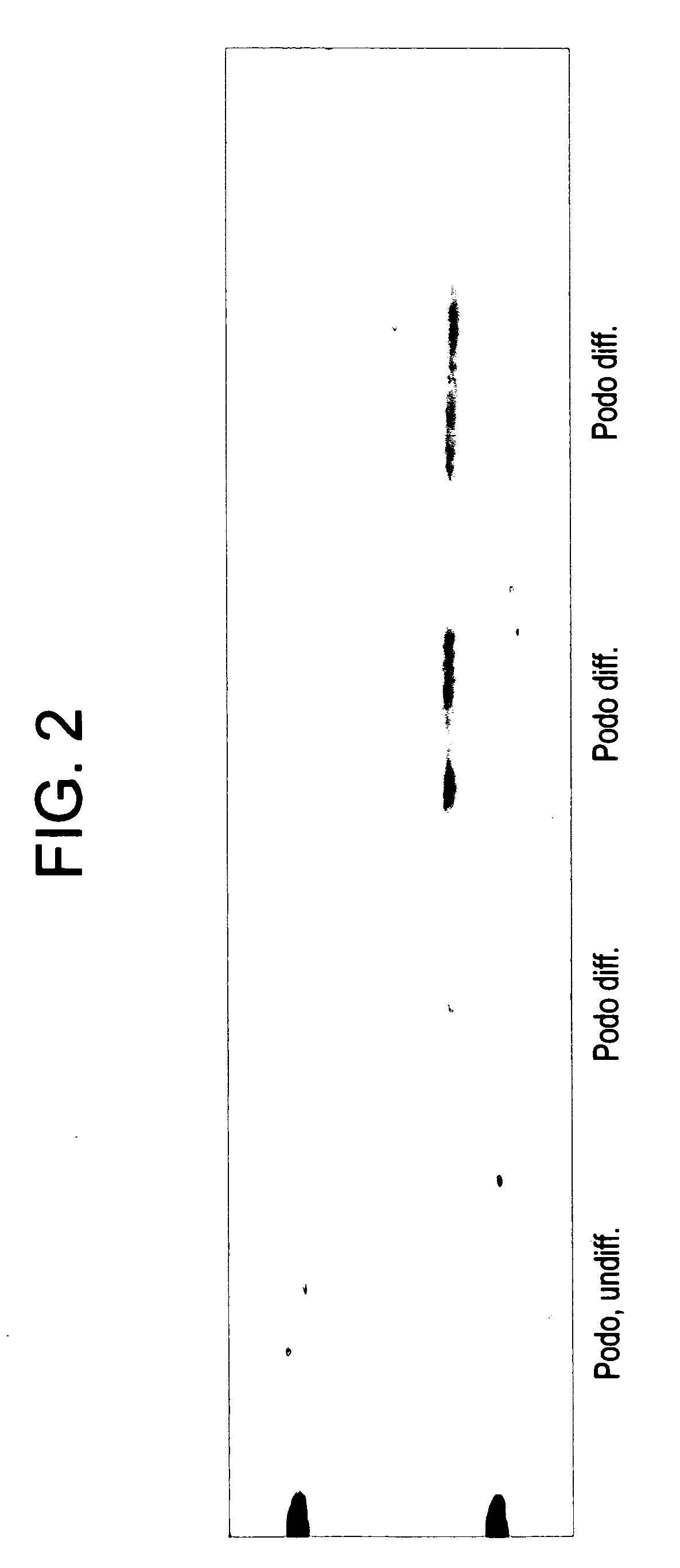 Methods for treating podocyte-related disorders