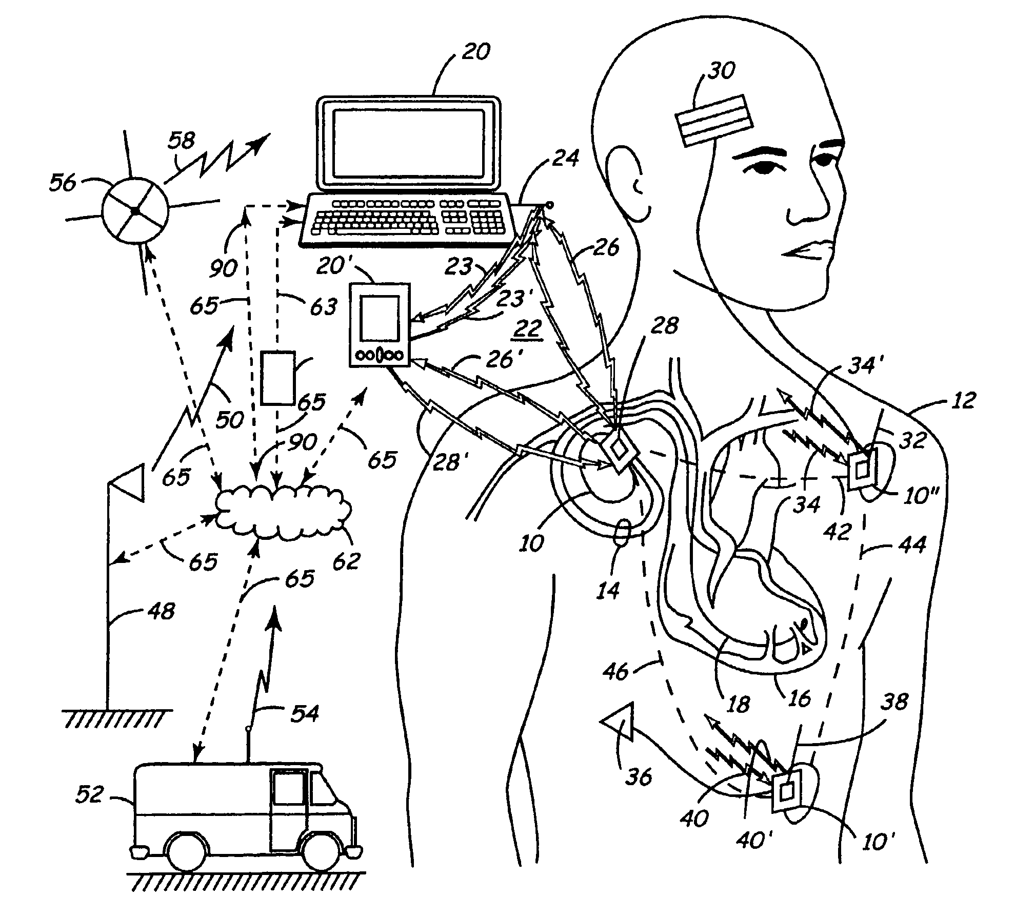 Apparatus and method for remote therapy and diagnosis in medical devices via interface systems