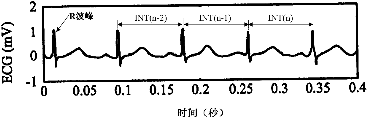 Atrial fibrillation detection device, wearable equipment and storage medium