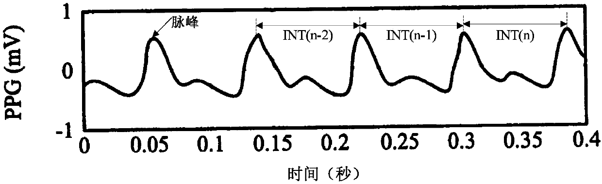 Atrial fibrillation detection device, wearable equipment and storage medium