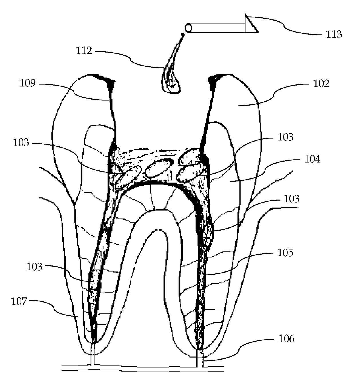 Composition and method of using medicament for endodontic irrigation, stem cell preparations and tissue regeneration