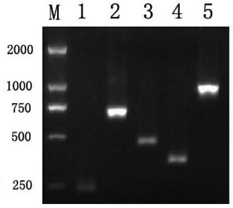 Multiplex PCR method for rapid detection and identification of five Listeria species
