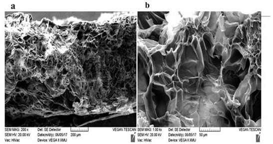 Preparation method of biodegradable hydrogel scaffold material for cardiac repair