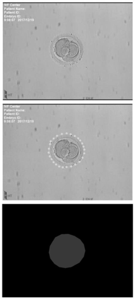 Occluded embryo pronucleus and cleavage ball detection method based on attention mechanism