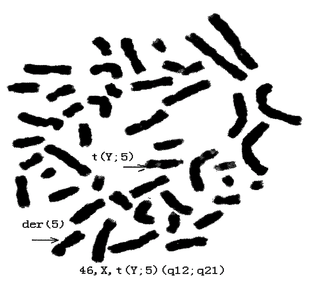 Abnormal karyotype image library and construction method for same