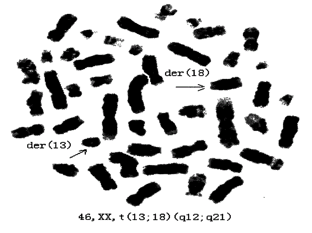 Abnormal karyotype image library and construction method for same