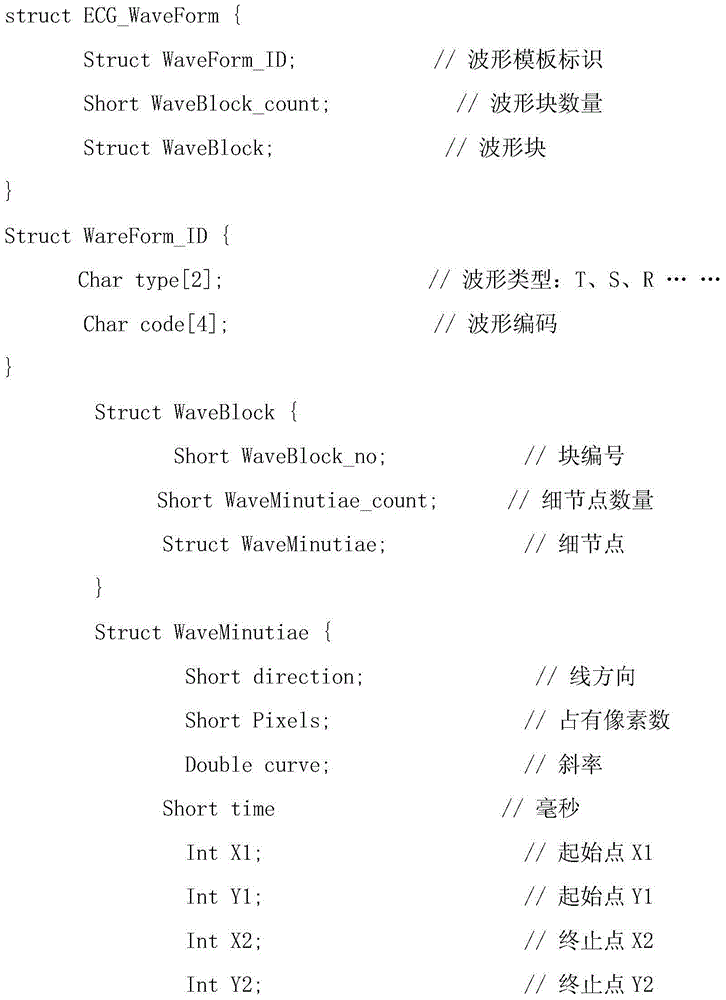 Polymorphism reconstruction and optimization method for realizing abnormal electrocardiogram template based on big data