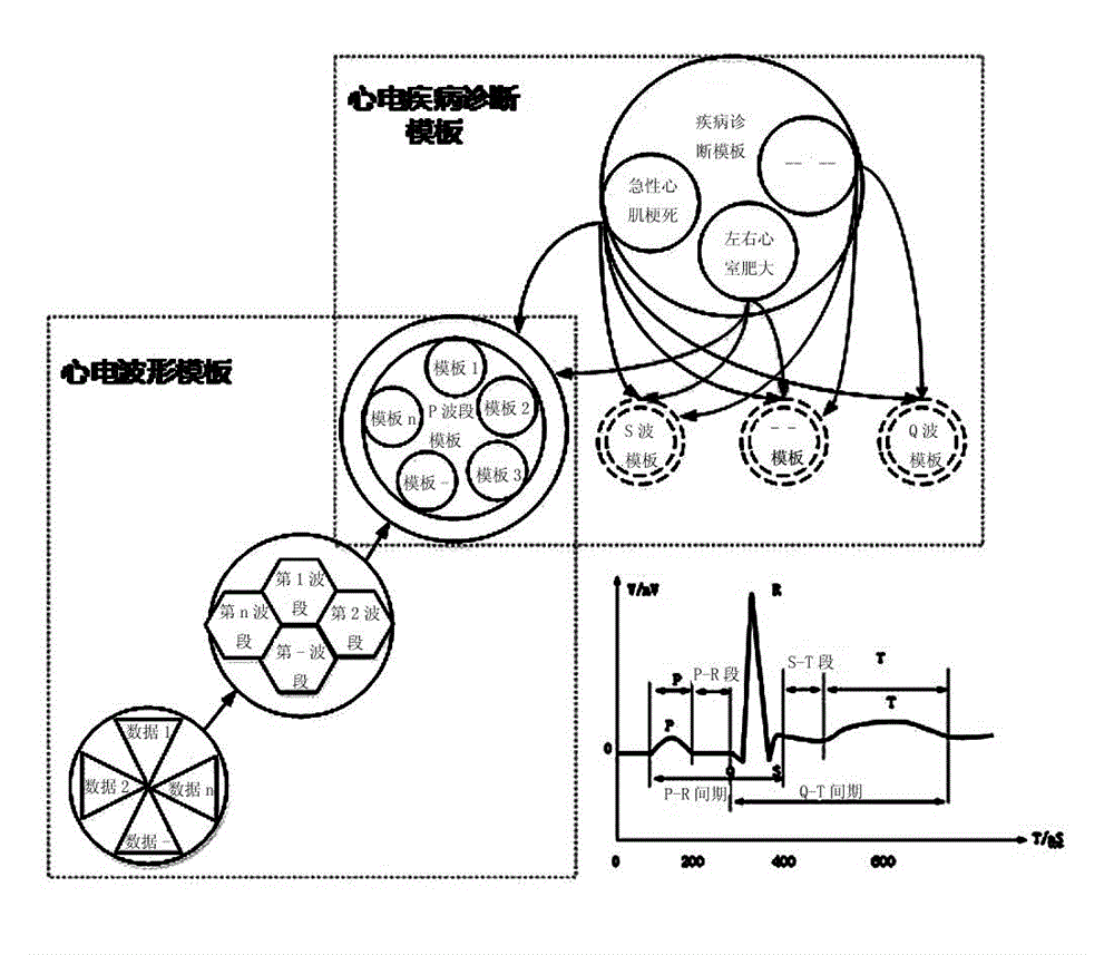 Polymorphism reconstruction and optimization method for realizing abnormal electrocardiogram template based on big data