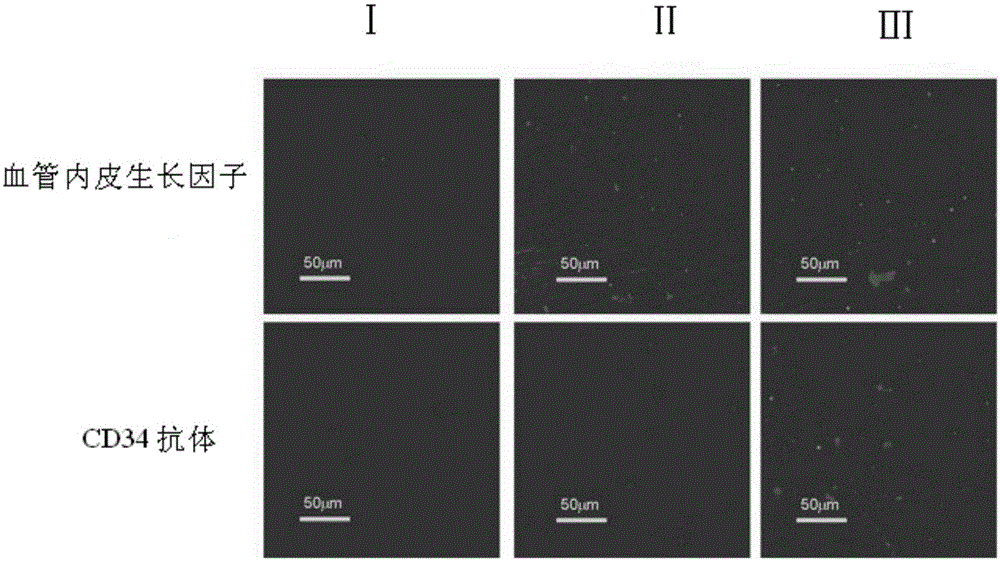 A kind of method for preparing degradable drug-loaded coating stent