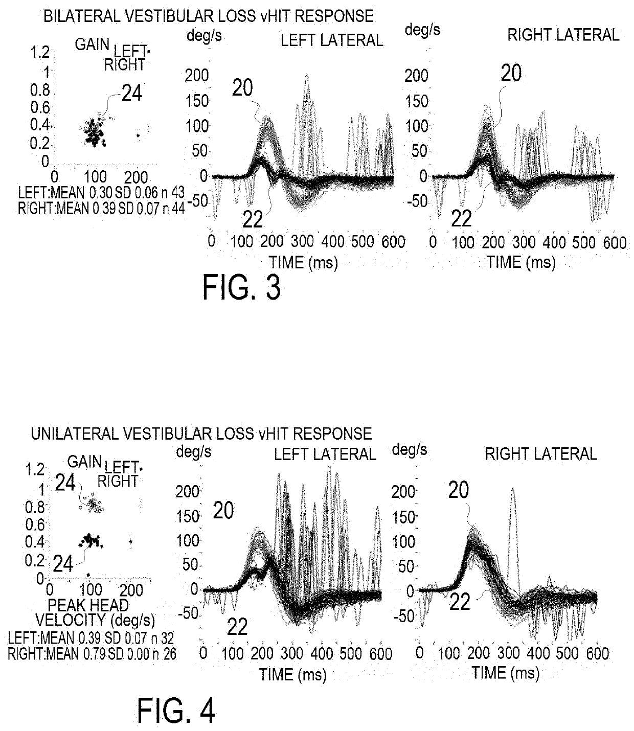 Apparatus and method for computerized rotational head impulse test