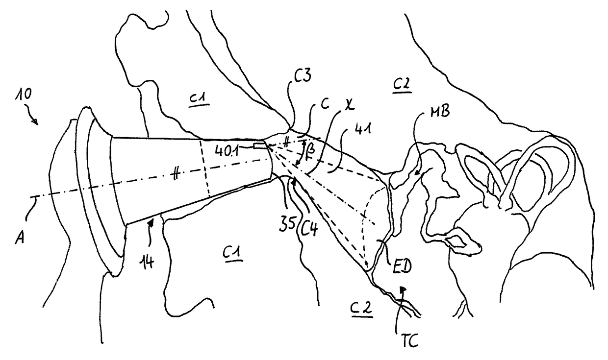 Method for identifying objects in a subject's ear