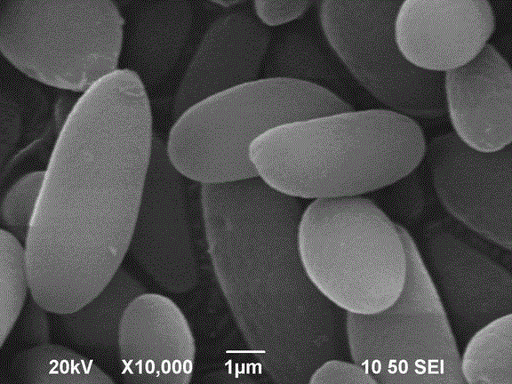 A strain of Rhodococcus spp. and its screening method and application