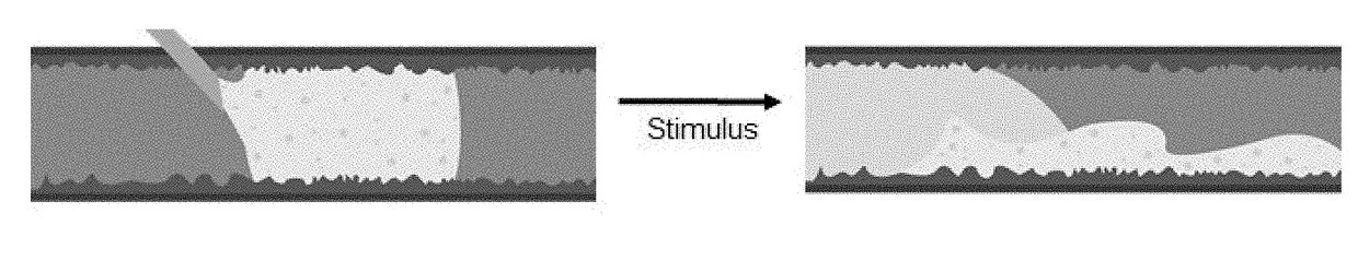 Methods for implanting and reversing stimuli-responsive implants