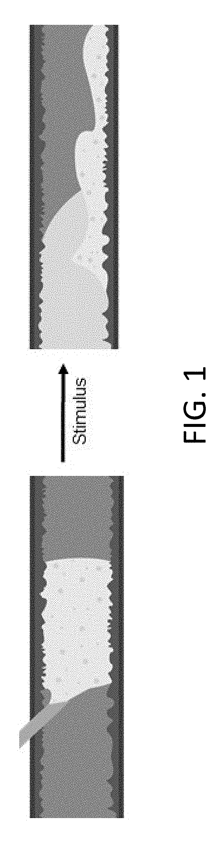 Methods for implanting and reversing stimuli-responsive implants