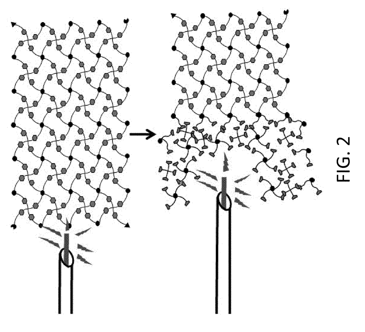 Methods for implanting and reversing stimuli-responsive implants