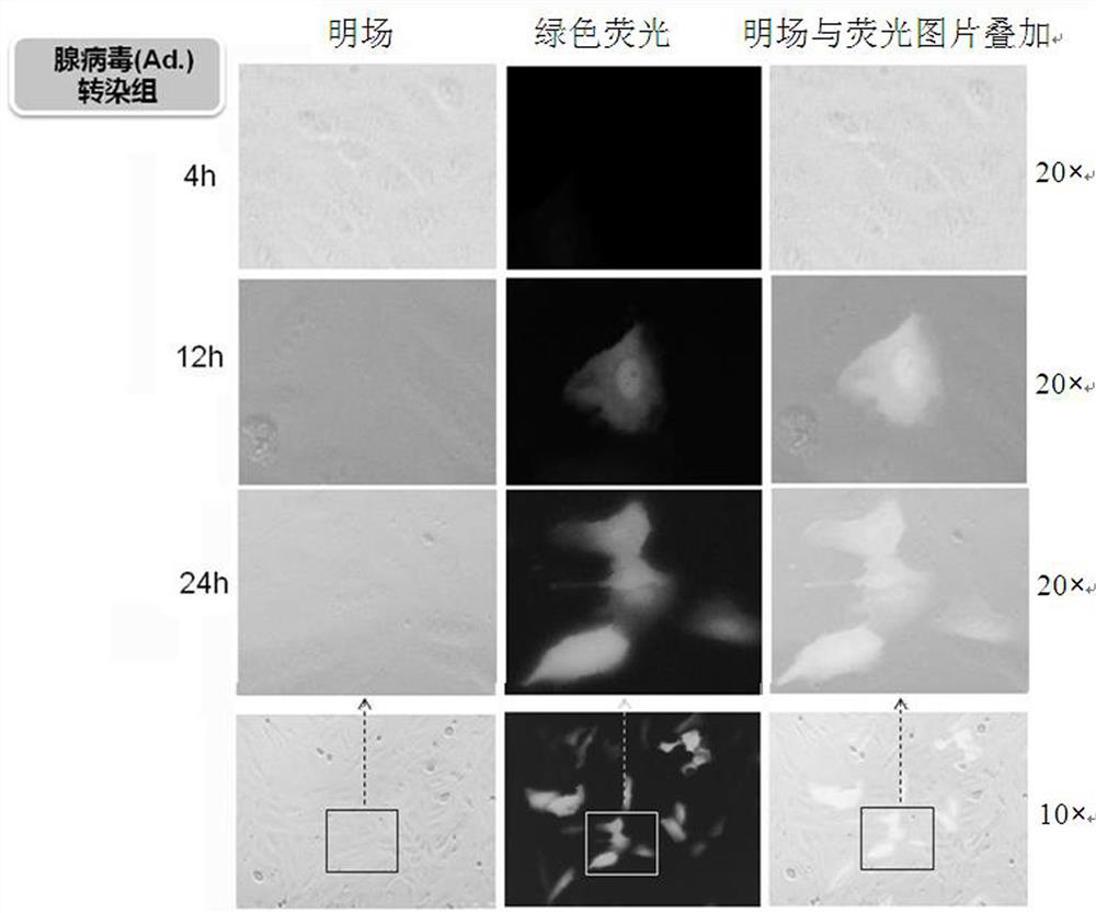 Application of nitrogen-doped carbon quantum dot delivery system in cartilage tissue