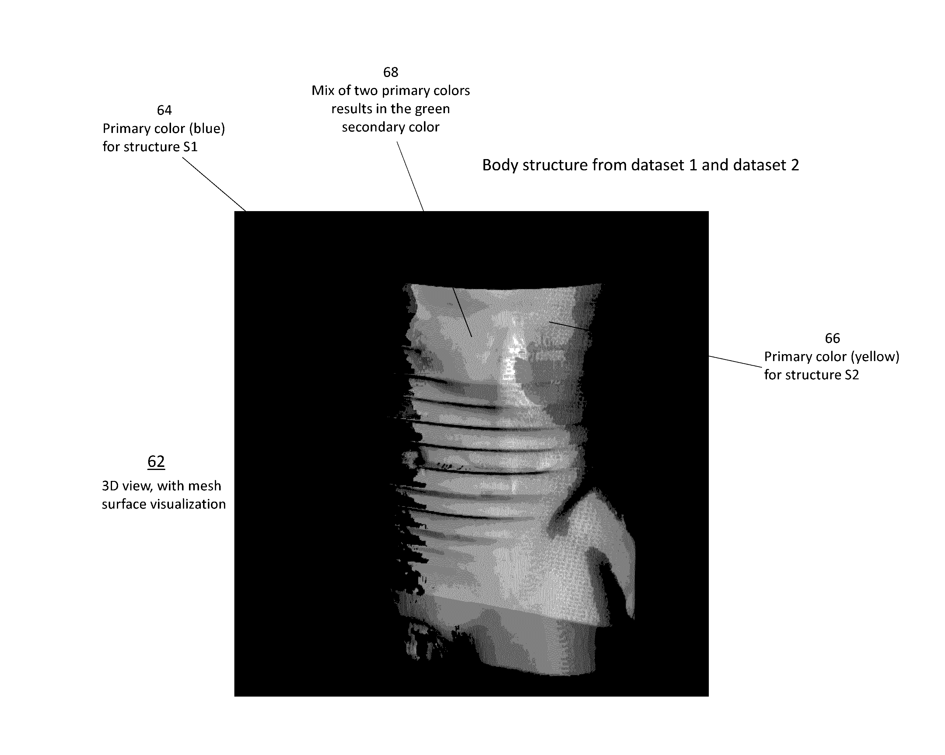 Methods and systems for three-dimensional visualization of deviation of volumetric structures with colored surface structures