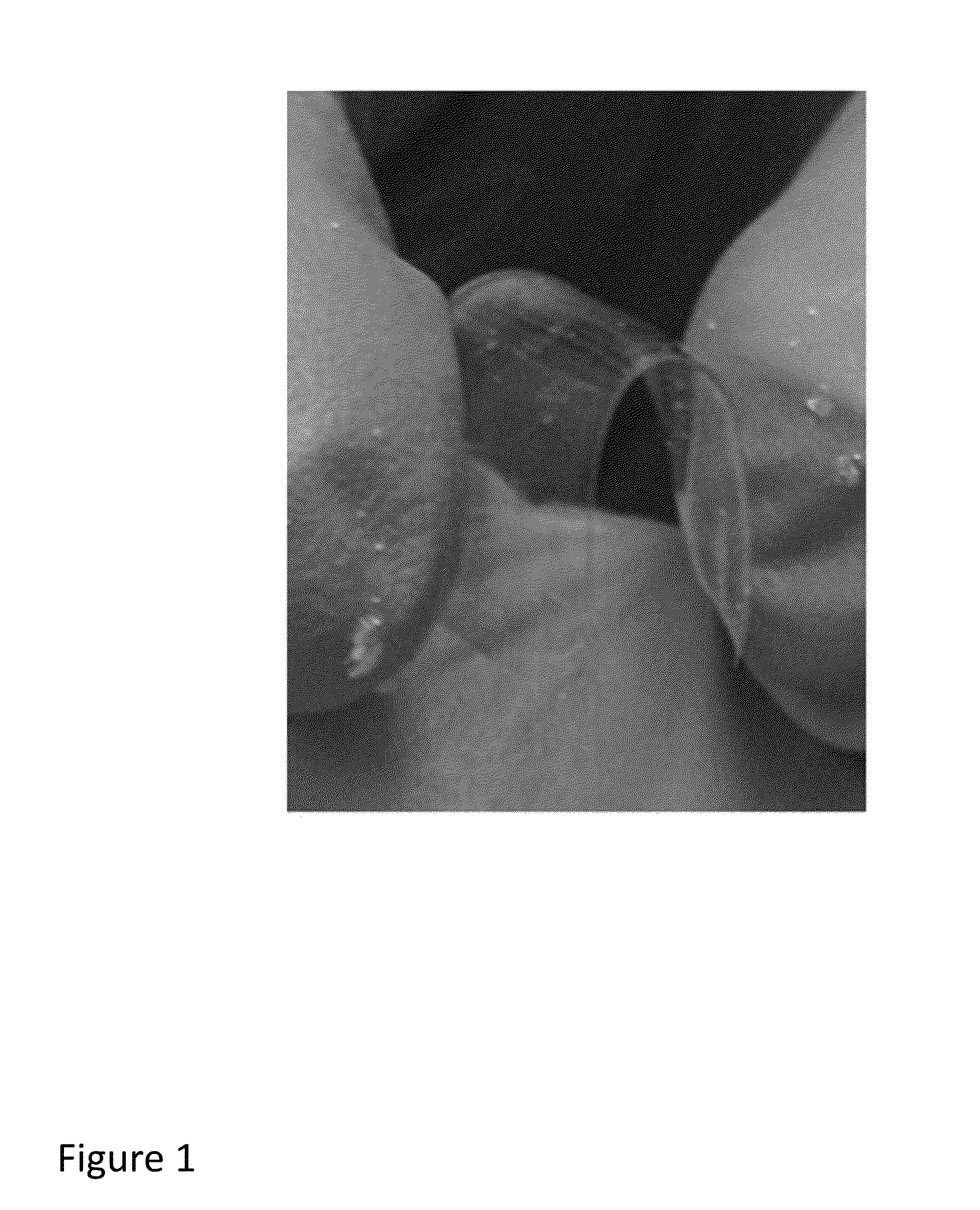 Polymer-tissue hybrid biomaterials and methods of making and using same