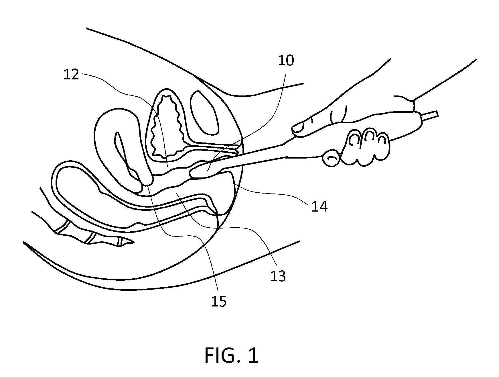 Methods for characterizing vaginal tissue elasticity