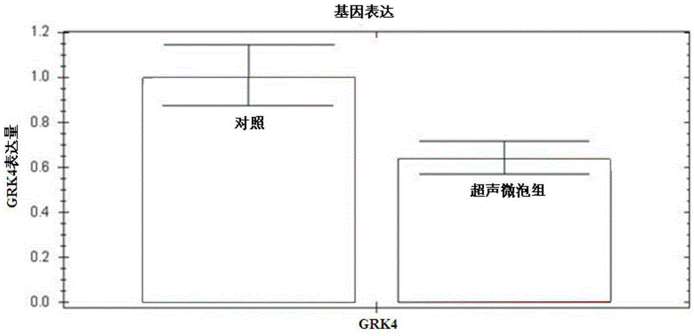 Application of ultrasound microbubble-mediated siRNA interference GRK4 in targeted adjustment of natriuresis and blood pressure level