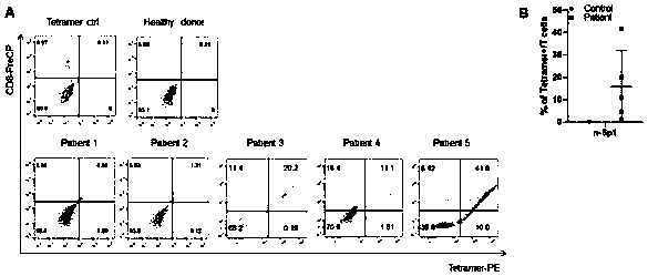 Novel coronavirus T cell epitope peptide, pMHC and preparation and application of novel coronavirus T cell epitope peptide