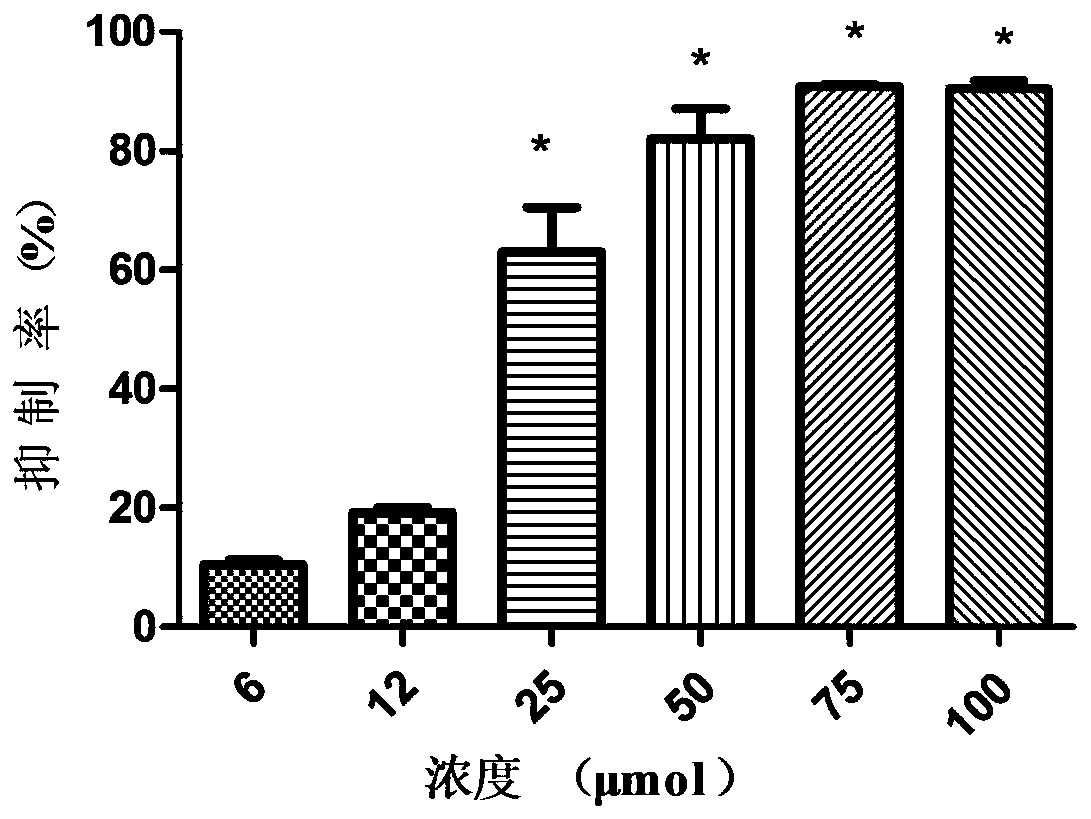 Application of mizoribine to preparation of medicine for preventing foot-and-mouth disease virus infection