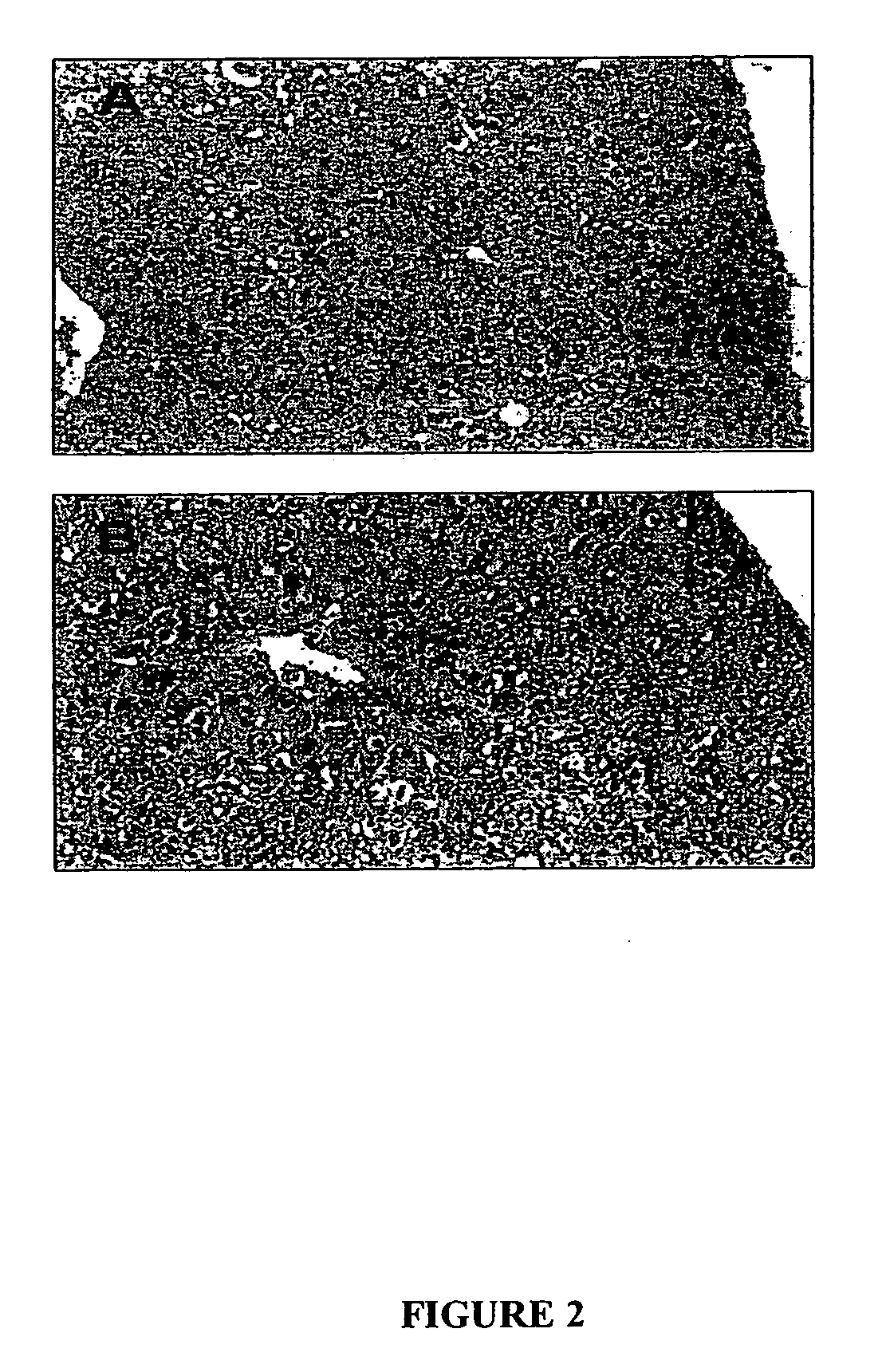 Pharmaceutical composition useful for the treatment of hepatocellular carcinoma