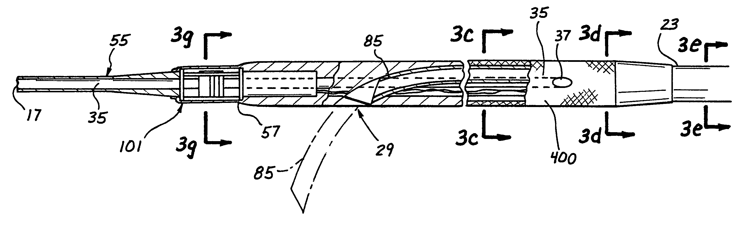 Tissue penetrating catheters having integral imaging transducers and their methods of use