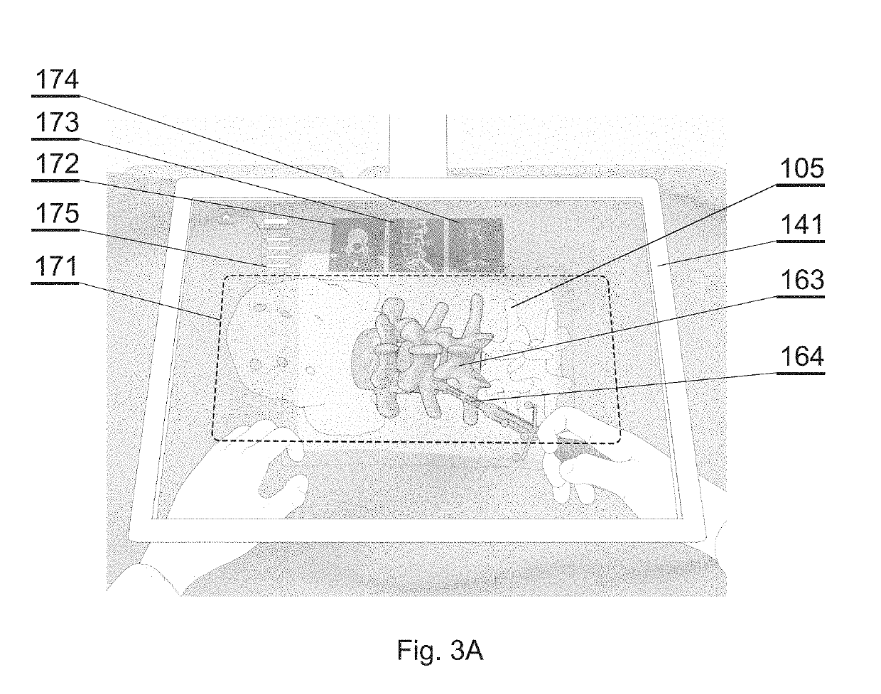Method for patient registration, calibration, and real-time augmented reality image display during surgery