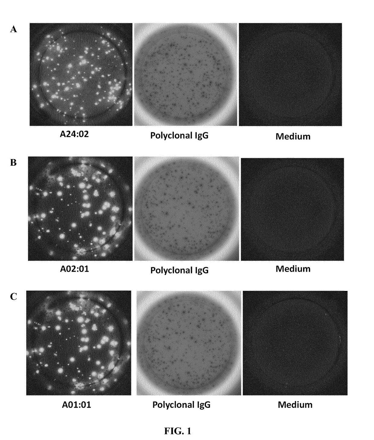 Method for detecting antibody-secreting b cells specific for HLA