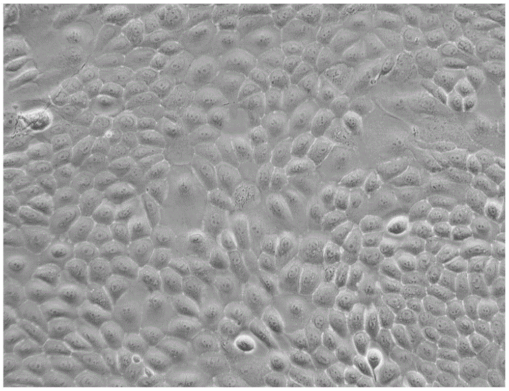 Spontaneously immortalized piglet oral mucosa epithelial cell line and construction method thereof