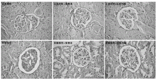 Applications of pterostilbene in preparation of medicines for preventing and treating chronic glomerular disease