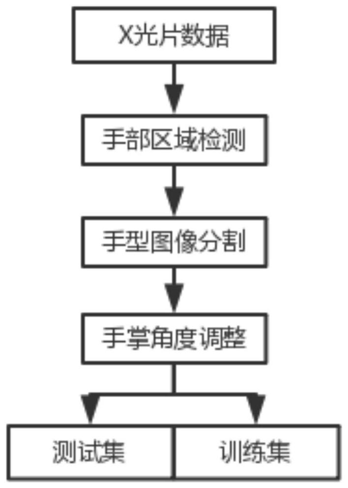 Image preprocessing method and system for reducing interference features of bone age evaluation model