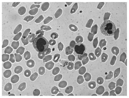 Full-automatic high-performance leukocyte segmentation method
