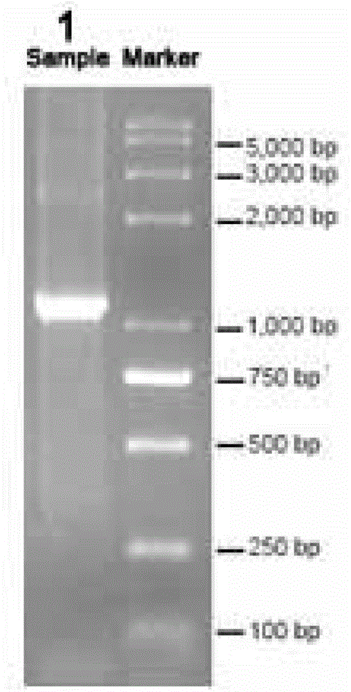 Thalassemia gene detection method based on fluorescence labeling quantitation PCR (Polymerase Chain Reaction) technology