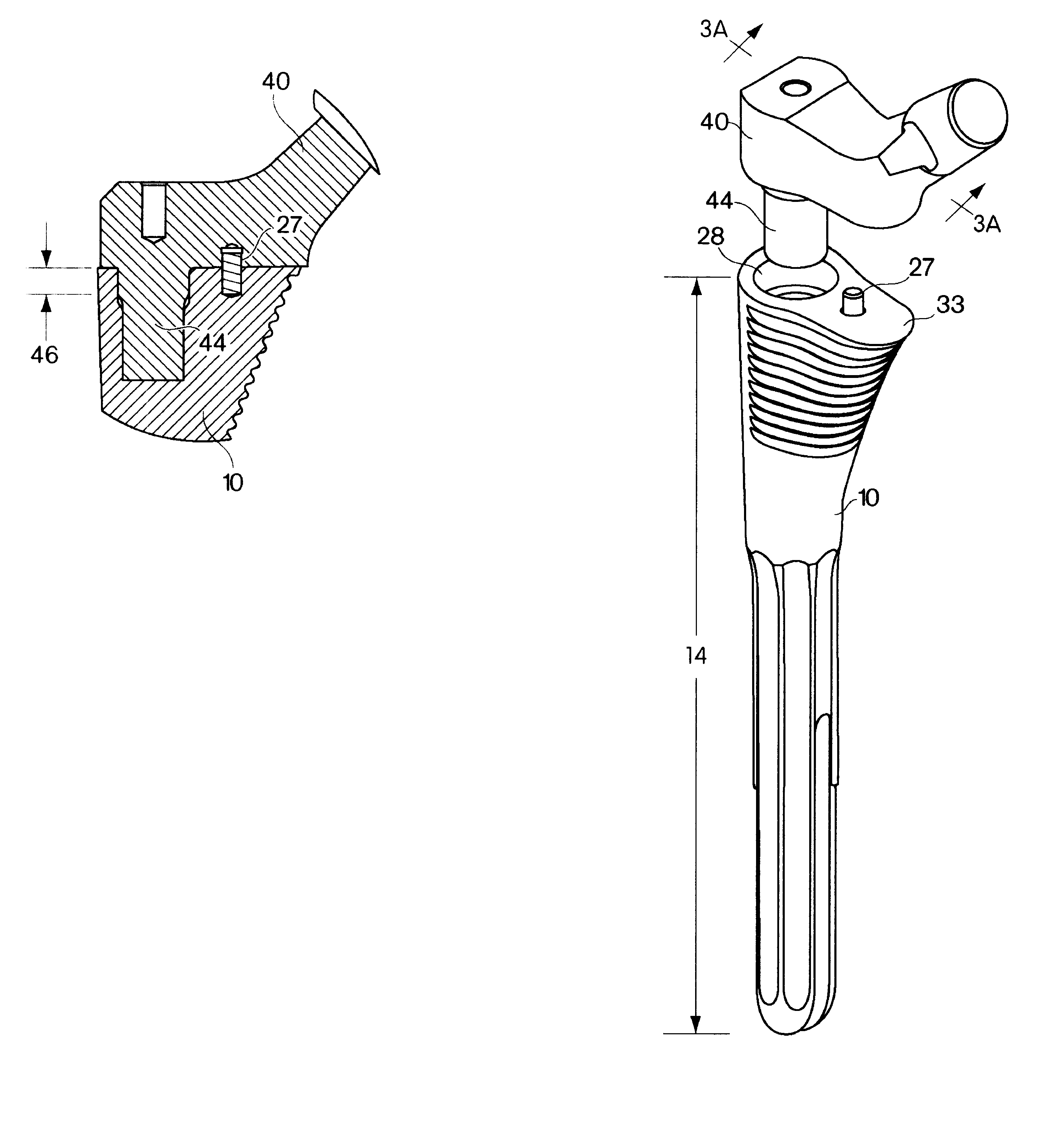 Joint prostheses and components thereof