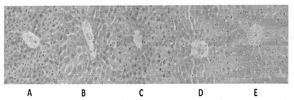 Standard extract of chemical components of fraxinus rhynchophylla hance seeds as well as preparation method thereof and application thereof