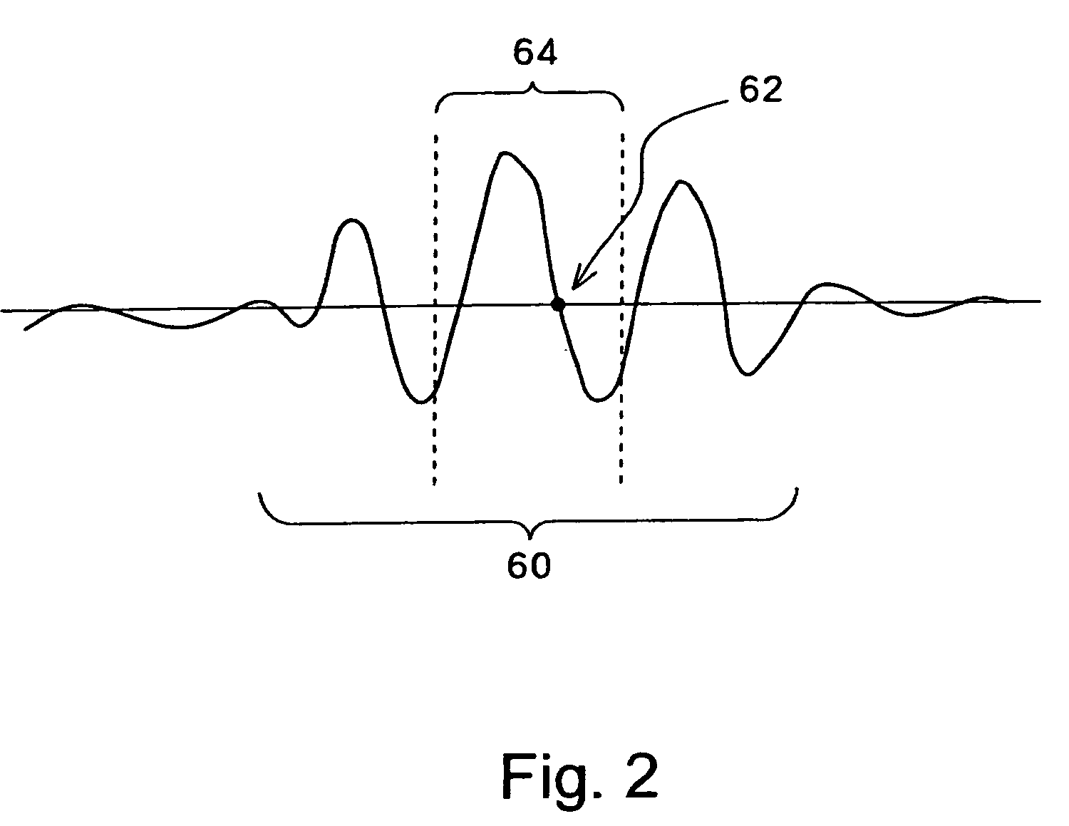 Ultrasonic diagnostic apparatus