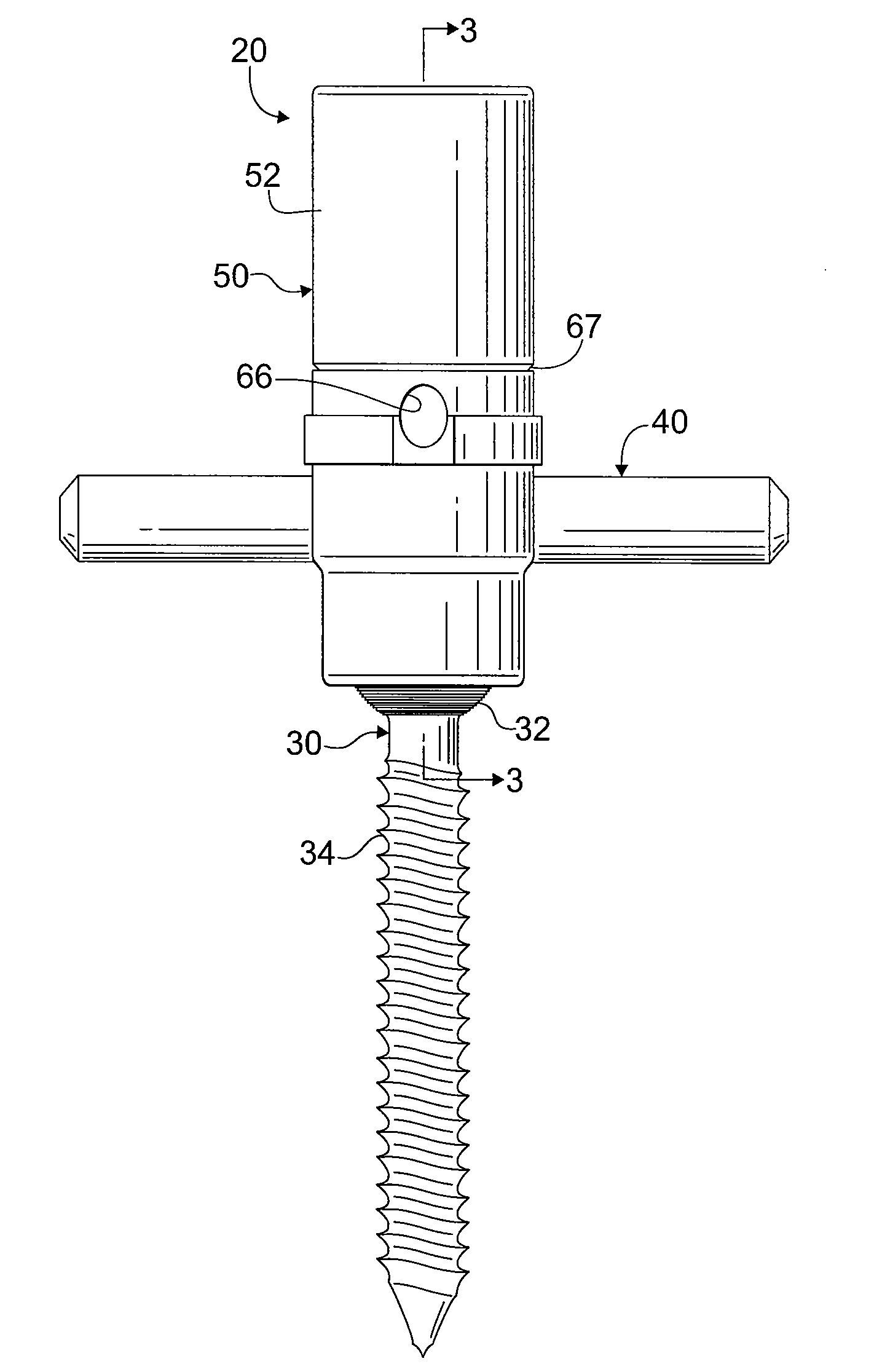 Pedicle screw fixation system