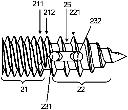 An anchor device and anchor system against osteoporosis