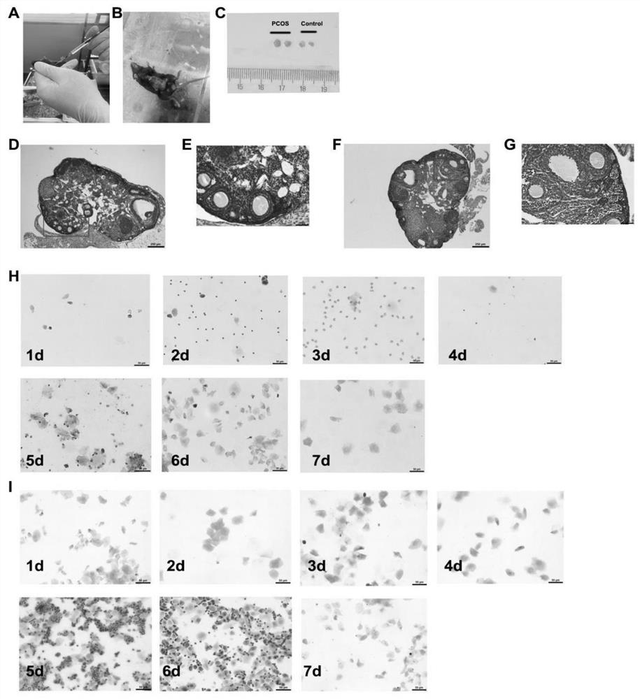 Application of lonicera caerulea anthocyanin extract in preparation of medicine and/or health care product for improving polycystic ovarian syndrome