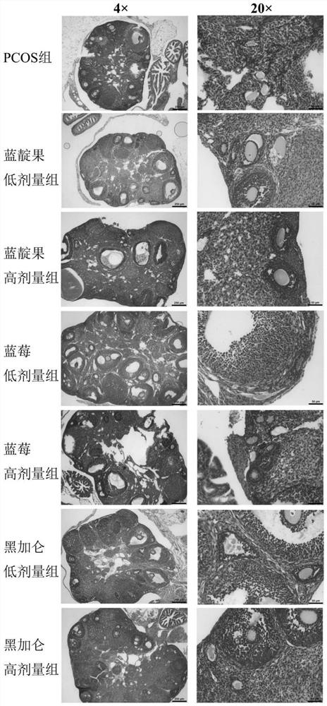 Application of lonicera caerulea anthocyanin extract in preparation of medicine and/or health care product for improving polycystic ovarian syndrome