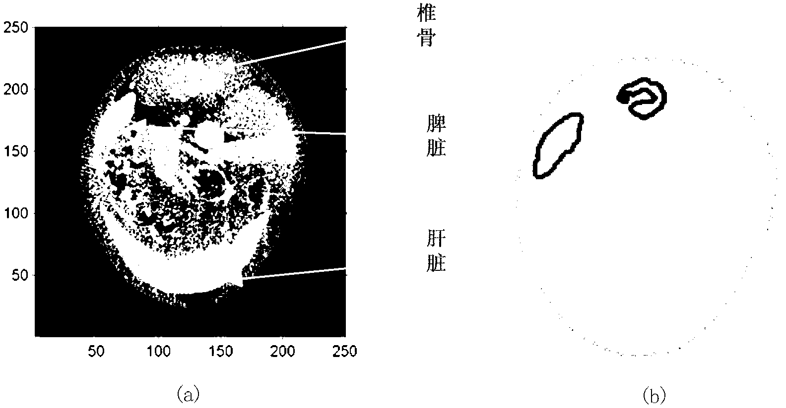 Image rebuilding algorithm of DOT/XCT (diffuse optical tomography/X-ray computer tomography) dual-mode imaging based on boundary element